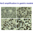 Her2 amplification in gastric models